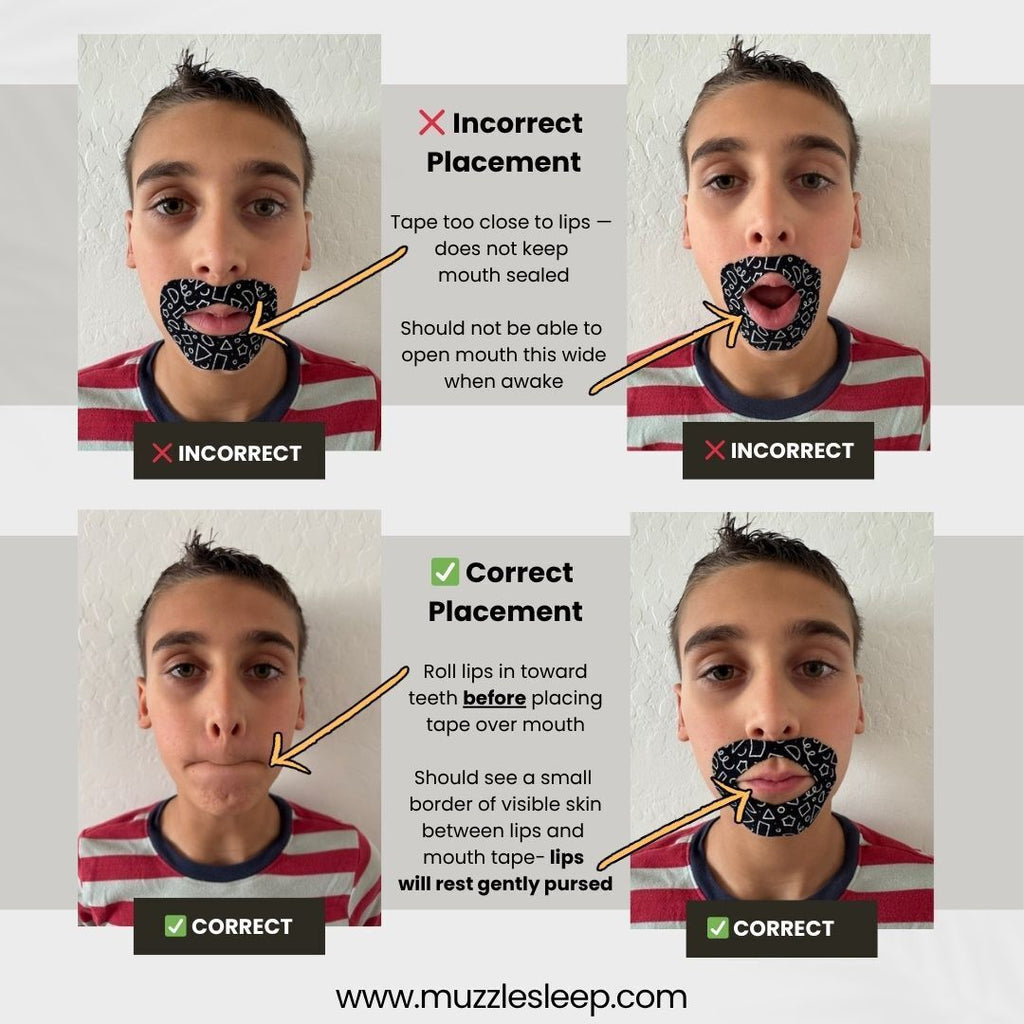 Muzzle® Mouth Tape For Kids (Extra Sensitive)